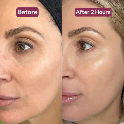 Dermly™ d'escargot 96 Mucine Masque