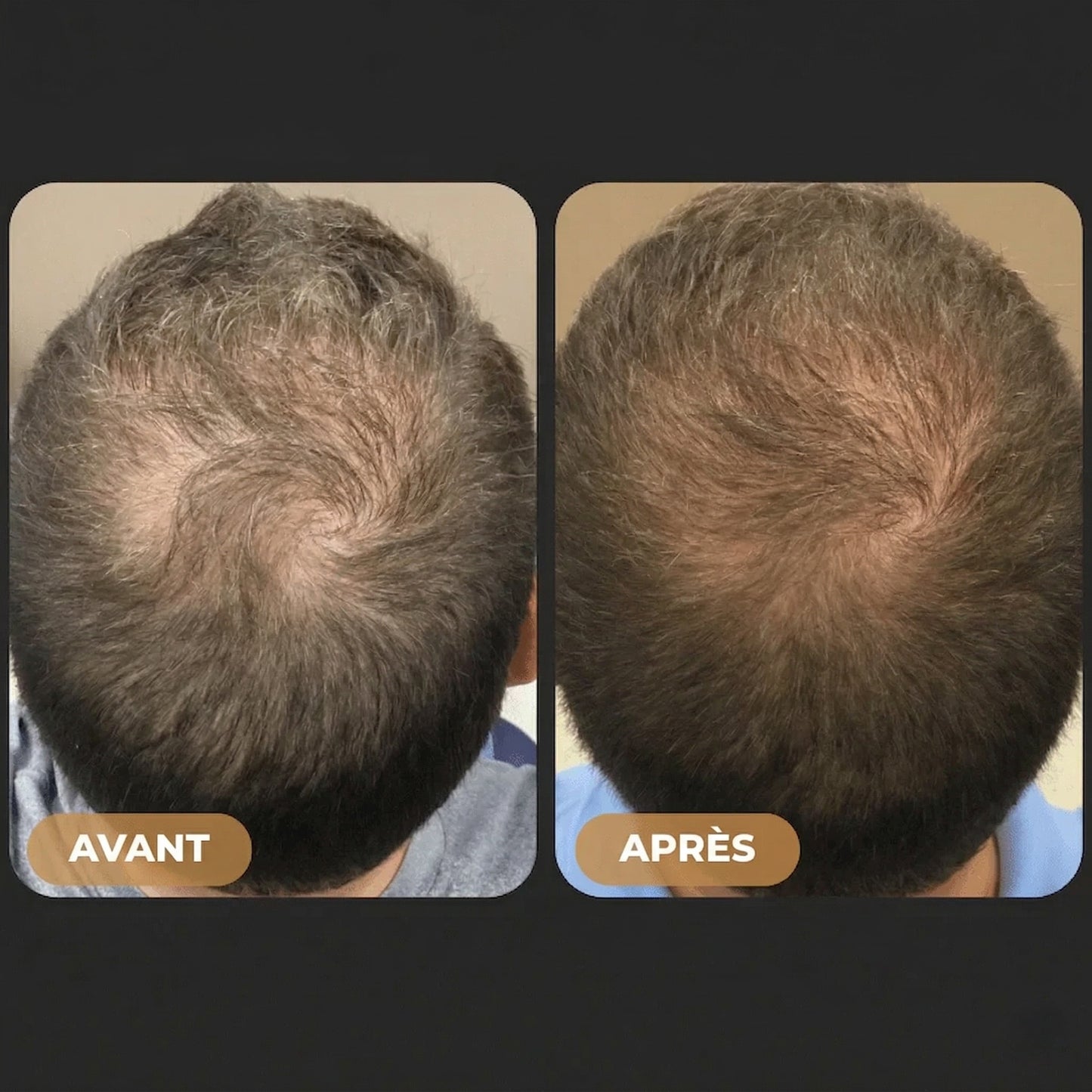 Shampooing Activateur de Racines