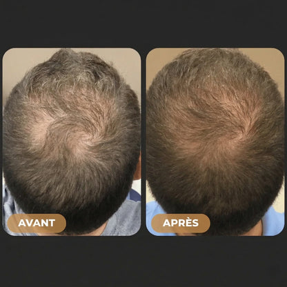 Shampooing Activateur de Racines