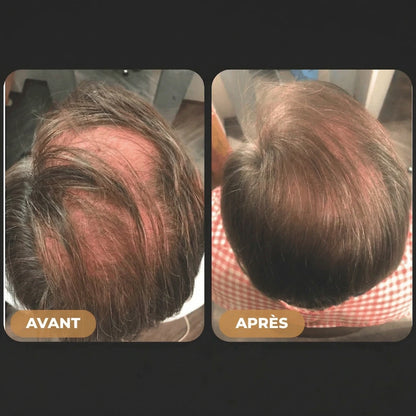 Shampooing Activateur de Racines