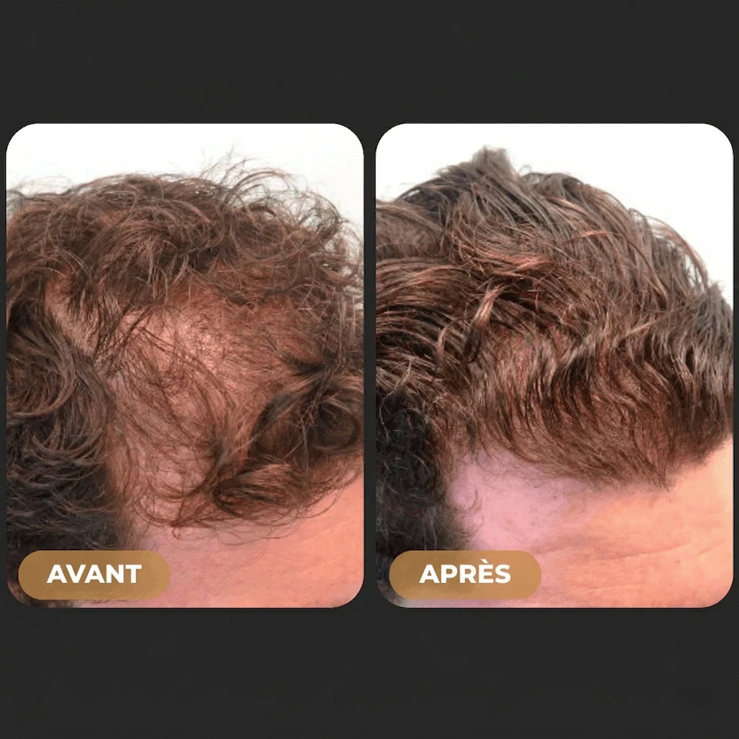 Shampooing Activateur de Racines